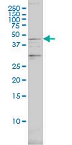 PSMC2 Monoclonal Antibody (4C10-2C8)