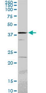 PSMC6 Monoclonal Antibody (2C4)