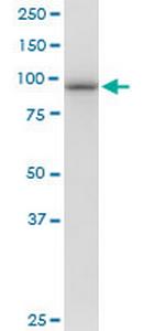 PSMD2 Antibody in Western Blot (WB)