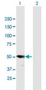 PSMD5 Polyclonal Antibody, MaxPab™