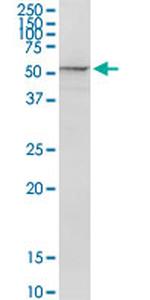 PSMD5 Antibody in Western Blot (WB)