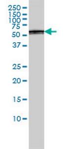 PSMD5 Antibody in Western Blot (WB)