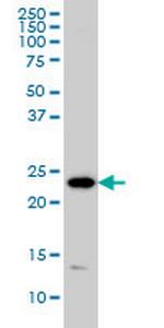 PSMD10 Monoclonal Antibody (4B5)