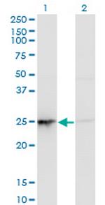 PSMD10 Monoclonal Antibody (3F10)
