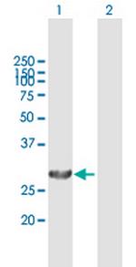 PSME1 Polyclonal Antibody, MaxPab™