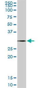 PSME2 Antibody in Western Blot (WB)