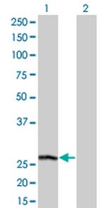 PSPH Antibody in Western Blot (WB)
