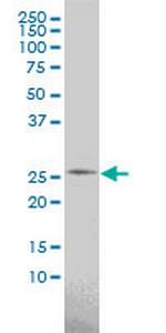 PSPH Monoclonal Antibody (2G9)