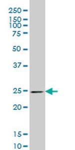 PSPH Monoclonal Antibody (3C1)