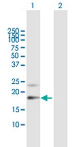 PTGDS Polyclonal Antibody, MaxPab™