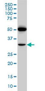 PTGIR Monoclonal Antibody (4B10)