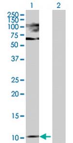 PTH Polyclonal Antibody, MaxPab™