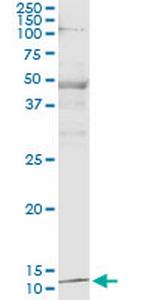 PTH Monoclonal Antibody (2E4)