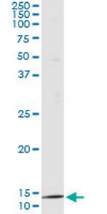 PTH Monoclonal Antibody (4C12)