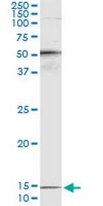 PTH Monoclonal Antibody (4A2)