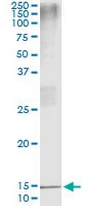 PTH Antibody in Immunoprecipitation (IP)