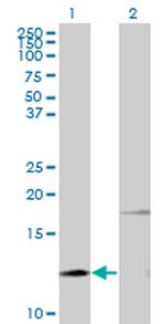 PTH Antibody in Western Blot (WB)