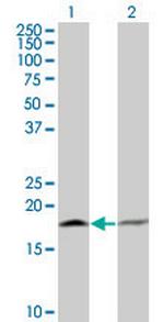 PTH Antibody in Western Blot (WB)