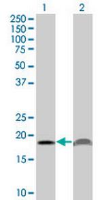PTH Antibody in Western Blot (WB)