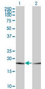 PTH Monoclonal Antibody (3D10)