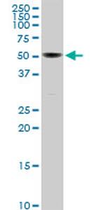 PTGS1 Antibody in Western Blot (WB)