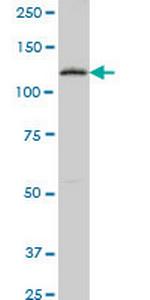 PTK7 Antibody in Western Blot (WB)