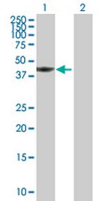 TWF1 Antibody in Western Blot (WB)