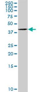 TWF1 Antibody in Western Blot (WB)