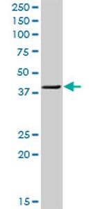 TWF1 Antibody in Western Blot (WB)