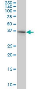 PTK9 Monoclonal Antibody (5C4)