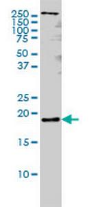 PTN Monoclonal Antibody (5C3)