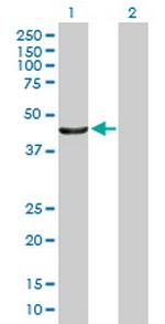 PTPN2 Polyclonal Antibody, MaxPab™