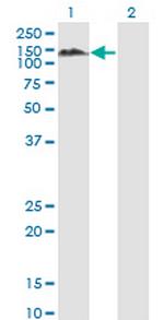 PTPN12 Monoclonal Antibody (4G6)