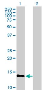 PTS Antibody in Western Blot (WB)