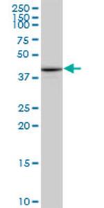 PTX3 Monoclonal Antibody (5B7)