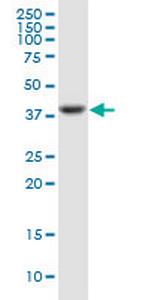 PTX3 Monoclonal Antibody (2B10)