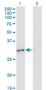RAD1 Monoclonal Antibody (1A12)