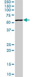 PVR Antibody in Western Blot (WB)
