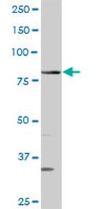 QARS Antibody in Western Blot (WB)