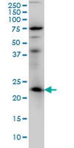 RAB3A Monoclonal Antibody (4H7)