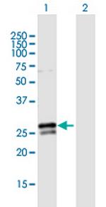 RAB3B Polyclonal Antibody, MaxPab™