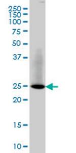 RAB3B Monoclonal Antibody (3F12)