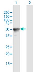 RAB3IL1 Polyclonal Antibody, MaxPab™