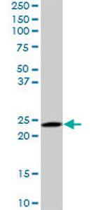 RAB6A Monoclonal Antibody (3G3)