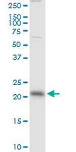 RAB13 Monoclonal Antibody (8H8)