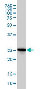 RAB27A Monoclonal Antibody (1G7)
