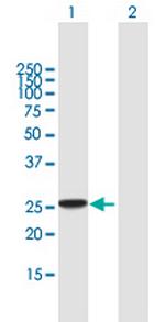 RAB27B Antibody in Western Blot (WB)