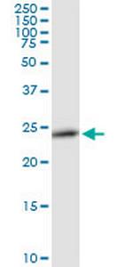 RAB27B Polyclonal Antibody, MaxPab™