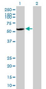 RAD23B Polyclonal Antibody, MaxPab™