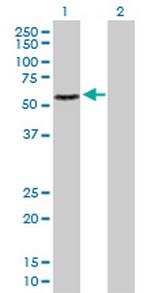 RAD23B Polyclonal Antibody, MaxPab™